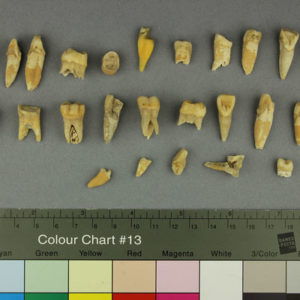 Ancient Egyptian human teeth