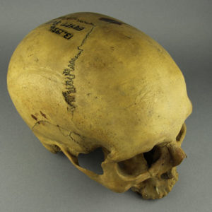 Ancient Egyptian human skull from Tobruk
 El Alamein area dated 50 – 1 BC